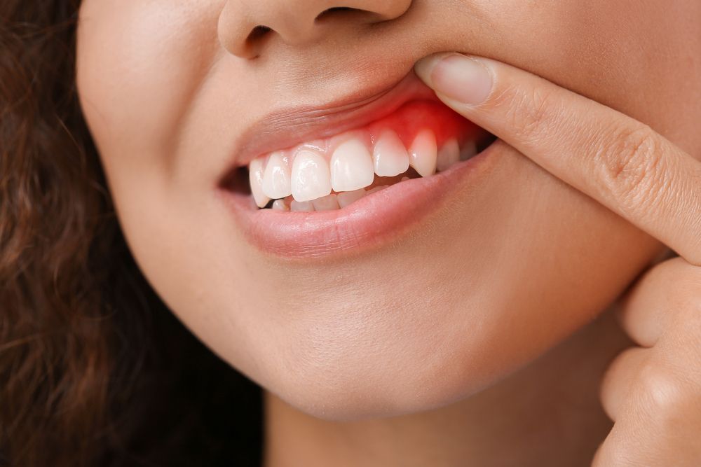 Can Receding Gums Grow Back? Latest Treatment Options Explained
