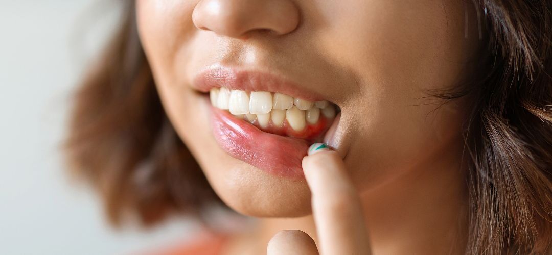 Don’t Ignore These 7 Warning Signs of Serious Gum Problems